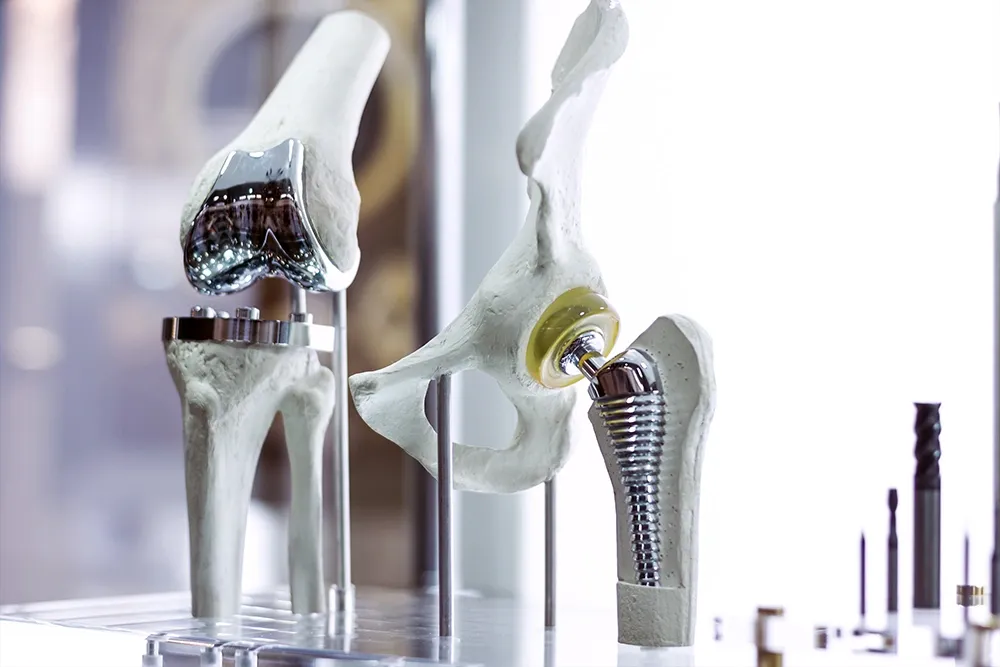 What Is Total Hip Replacement Surgery?