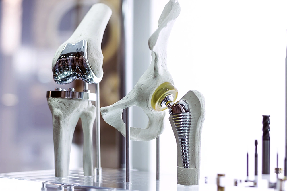 What Is Total Hip Replacement Surgery?
