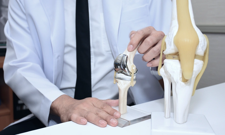 Total Knee Replacement Surgery